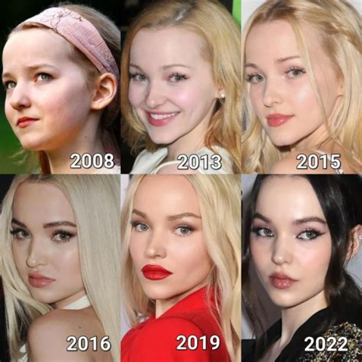 Dove Cameron Before Plastic Surgery, Feet, Age, Instagram, Bio, Wiki & More