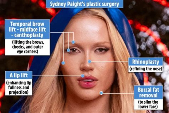 Sydney Love Island Before Surgery: Sydney Paight Before And After Photos