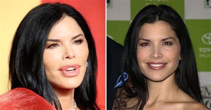 Ted Lasso Hannah Waddingham Botox Before And After Plastic Surgery Photos