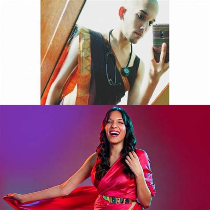 Trinetra Haldar Before Surgery: How Did She Look Previously?